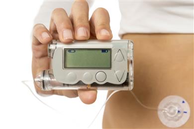 In der Gesundheitsbranche werden weiterhin immer mehr Handgeräte und tragbare Technologien benötigt, die den Bedarf an Materialien verstärken, mit denen kleine, leichtgewichtige Produkte mit High-Tech-Funktionalität hergestellt werden können. XENOY™ Kunststoffe, die für tragbare Insulinpumpengehäuse verwendet werden können, bieten Stoßfestigkeit und verbesserte chemische Beständigkeit gegenüber häufig verwendeten kosmetischen Chemikalien wie Mückenspray und Sonnenschutz. LEXAN™ HP Typen werden für die Linse verwendet, bieten ausgezeichnete Transparenz und verbinden sich gut mit XENOY, um Wasserdichte zu gewährleisten.