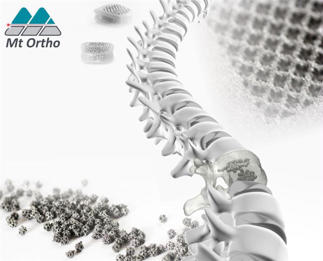 MT Ortho - kyphoplasty procedure.
(Foto: GE Additive, GEADPR039)