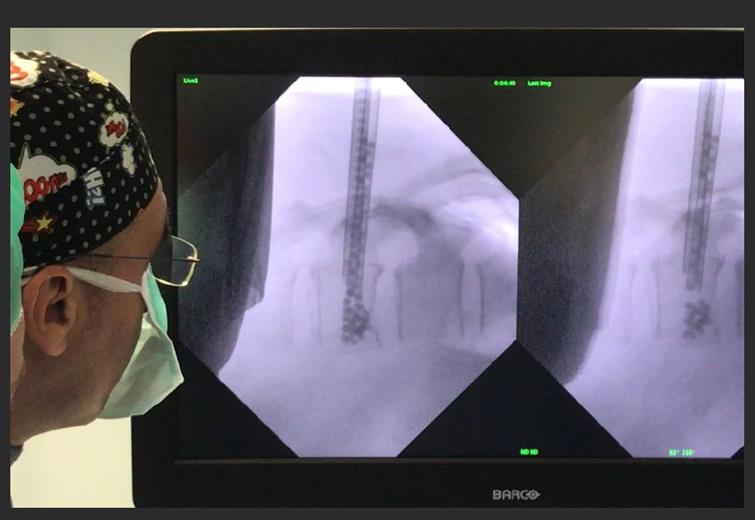 MT Ortho - kyphoplasty procedure.
(Foto: GE Additive, GEADPR039)