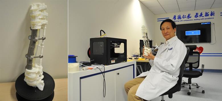 Professor Lui pictured with implants manufactured for patient Mr. Yuan.
(Photo: Peking University Third Hospital)
