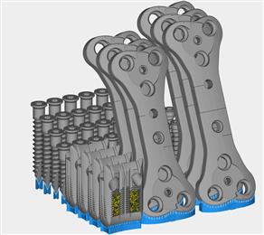 Manufactured by 3D Medical on its fleet of GE Additive’s Mlab printers, the 3D-printed titanium implants (plates, screws and cages) have a spongy, mesh rib-like shape to allow the bone and ligament tissues to adhere well to the prosthesis. (Photo: 3D Medical, GEADPR058)
