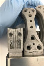 Manufactured by 3D Medical on its fleet of GE Additive’s Mlab printers, the 3D-printed titanium implants (plates, screws and cages) have a spongy, mesh rib-like shape to allow the bone and ligament tissues to adhere well to the prosthesis. (Photo: 3D Medical, GEADPR058)