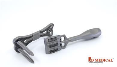 3D-printed neck implants manufactured by 3D Medical in titantium alloy on GE Additive Mlab machines. (Photo: 3D Medical, GEADPR058)