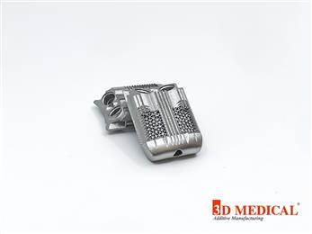 3D-printed neck implants manufactured by 3D Medical in titantium alloy on GE Additive Mlab machines. (Photo: 3D Medical, GEADPR058)